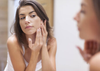 Huidafwijkingen bij uitdovende acne