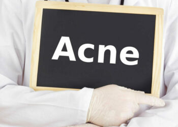 Feiten Over Acne