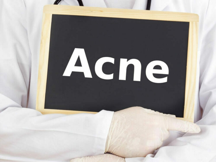 Feiten Over Acne