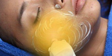 Gezichtsmassage Behandeling