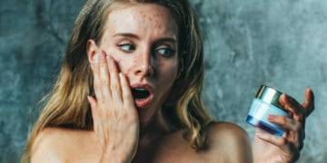 Vrouw Met Verkeerde Behandeling Voor Acne