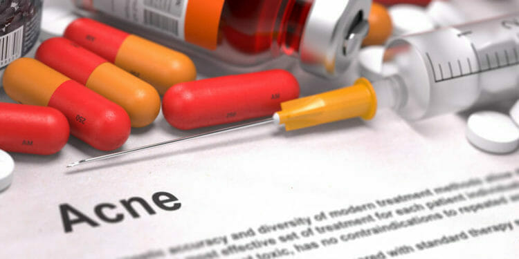 Acne Medicatie
