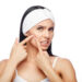 Hulp Tegen Acne